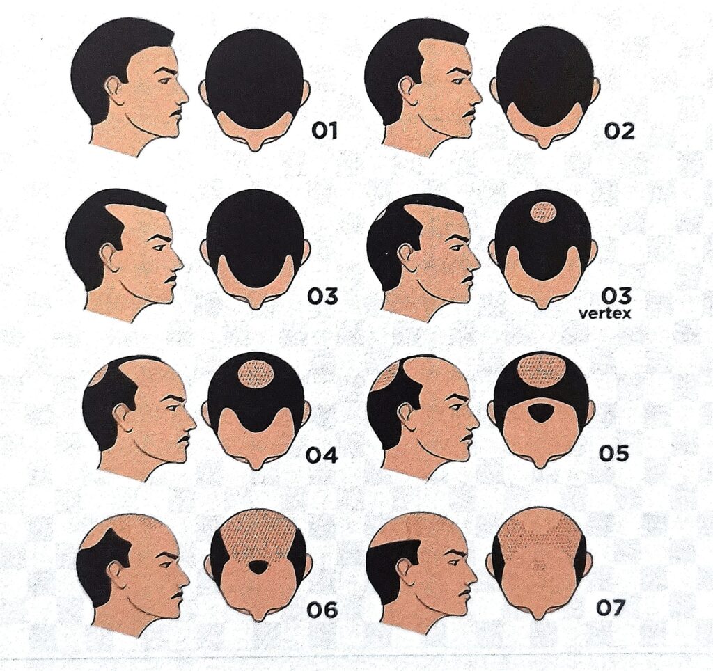 Zones et tarifs micropigmentaion capillaire