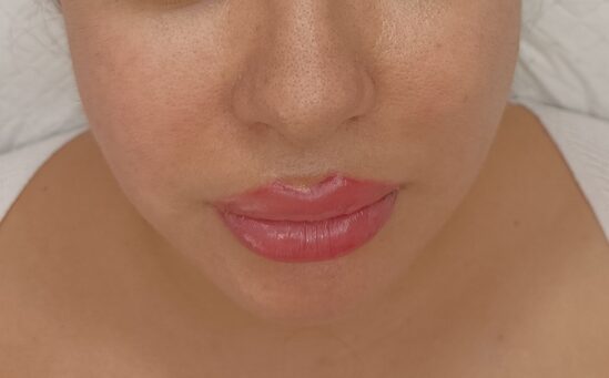 Maquillage permanent Lèvre