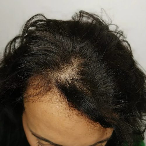 Micropigmentation cheveux femme